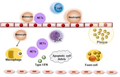 Subclinical Atherosclerosis in Primary Sjögren's Syndrome: Does Inflammation Matter?